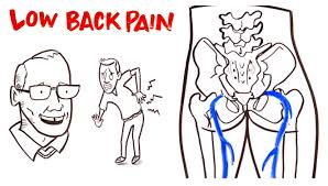 Low back myths